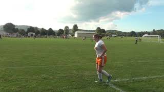 Benton Clip 17