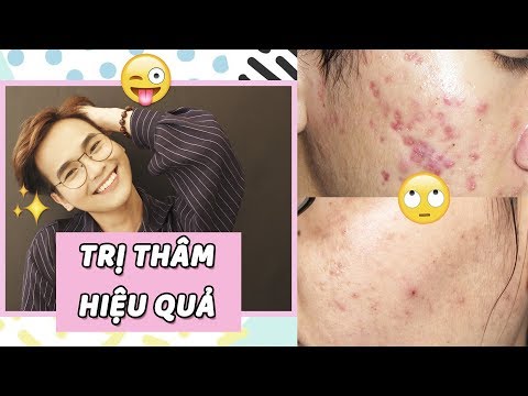 Sản Phẩm Trị Thâm Mụn Hiệu Quả ♡ Drugstore | Mid-end | High-end ♡ DungOiDungA