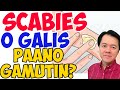 Scabies o Galis  - Payo ni Doc Willie Ong #99