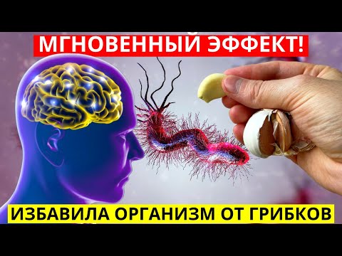Избавляем Организм От Грибков! Это Надо Знать Каждому