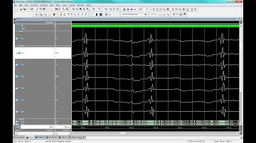 Approximate Pruned and Truncated Haar Discrete Wavelet Transform VLSI Hardware for Energy Efficient