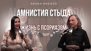 Я боюсь, что женщины меня не примут. Амнистия стыда с Лианой Николо