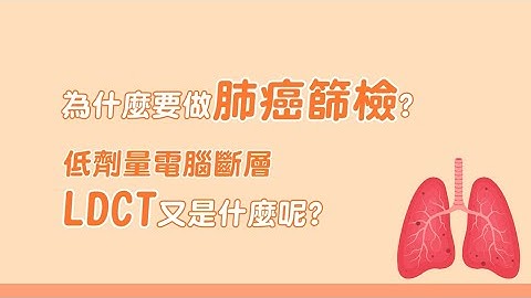 LDCT篩檢(低劑量電腦斷層檢查)介紹