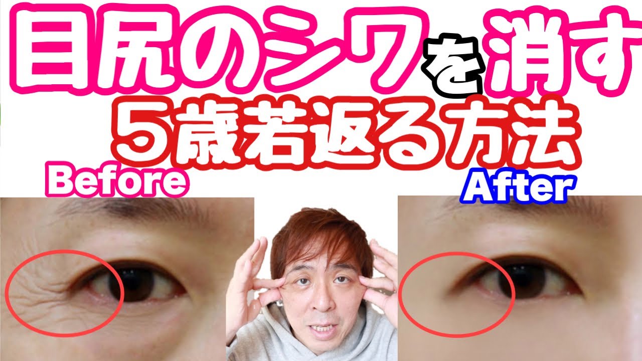 目尻のシワ 目の笑いジワを消す方法 Youtube