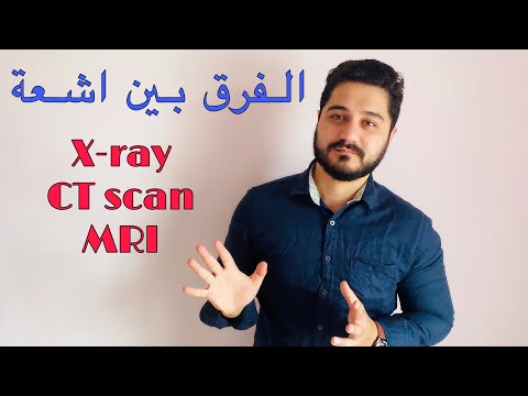 فيديو: هل cdt و ct هو نفسه؟