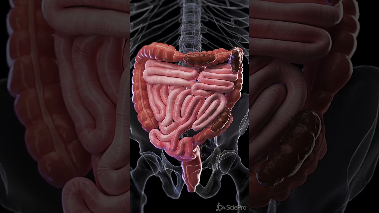 Constipation 3d Animation Meded Anatomy 3dmodel