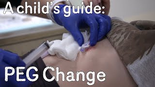 A child's guide to hospital: PEG Change