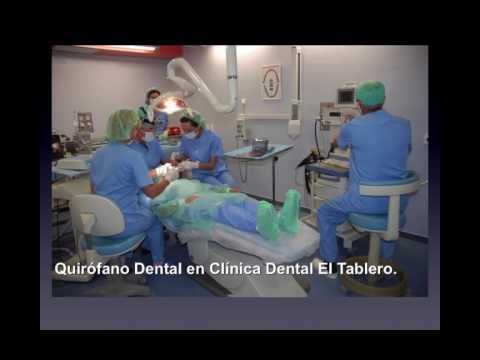 Rehabilitación Oral completa a dientes e implantes Caso clínico 11