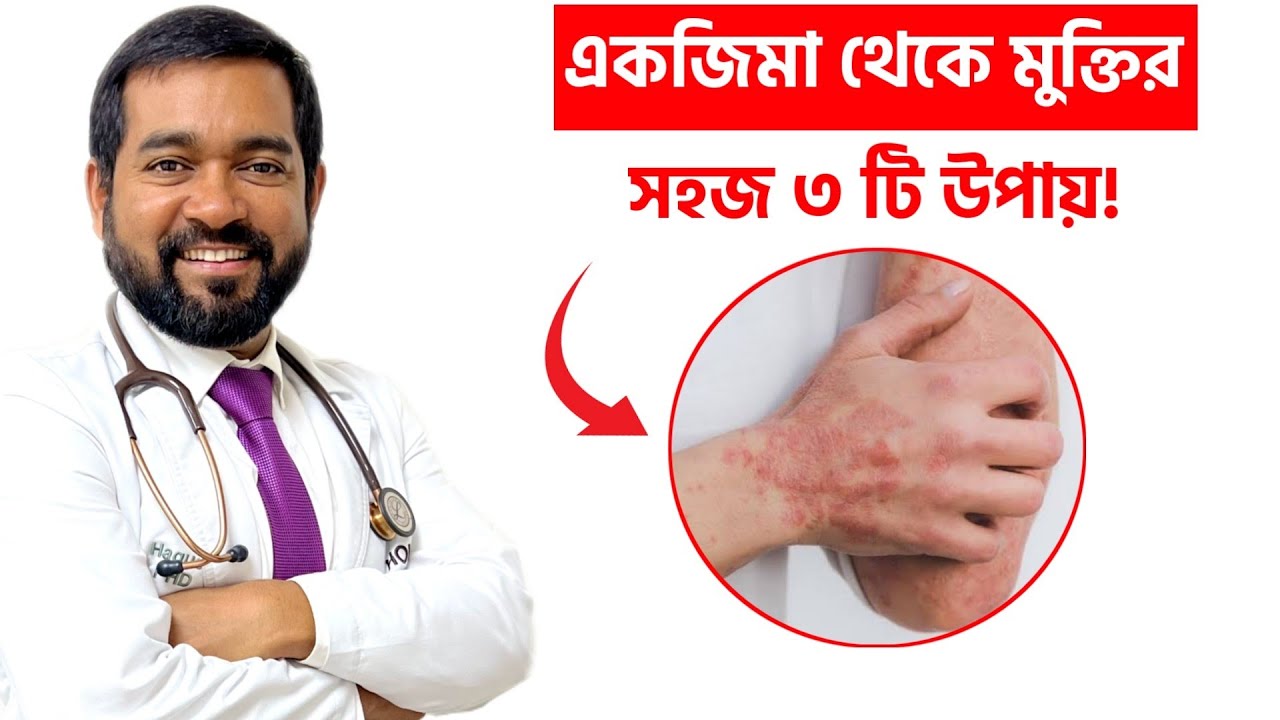 জেনে নিন একজিমা থেকে মুক্তির সহজ ৩ টি পদ্ধতি! Dr Mojibul Haque