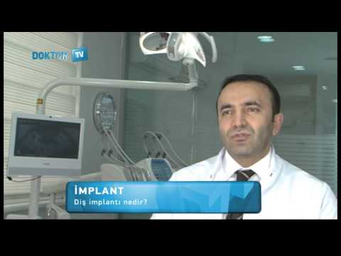 Diş Implantı Nedir?