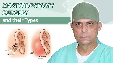 Mastoidectomy Surgery & Types | मास्टॉयडेक्टॉमी सर्जरी के प्रकार  | Dr. Major Rajesh Bhardwaj
