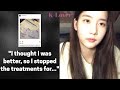Han Seo Hee Reveals Her Mental Health Diagnosis!