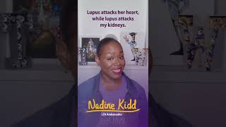 Lupus affects everyone differently