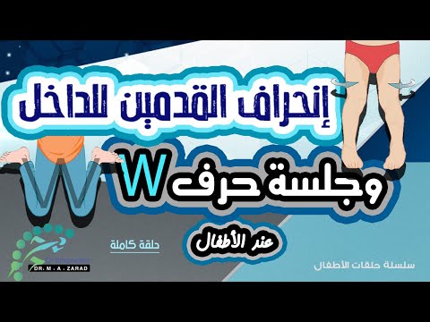 إنحراف دوران اعوجاج القدمين للداخل عند الأطفال أثناء المشي وخطورة جلوس الطفل على شكل حرف 