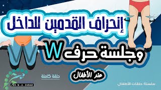 إنحراف [ دوران - اعوجاج ] القدمين للداخل عند الأطفال أثناء المشي | وخطورة جلوس الطفل على شكل حرف W