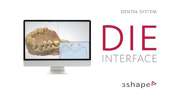 3Shape Dental System - Die interface