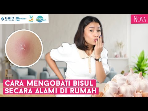 Video: Cara Menghilangkan Bisul Gusi: 10 Langkah (dengan Gambar)