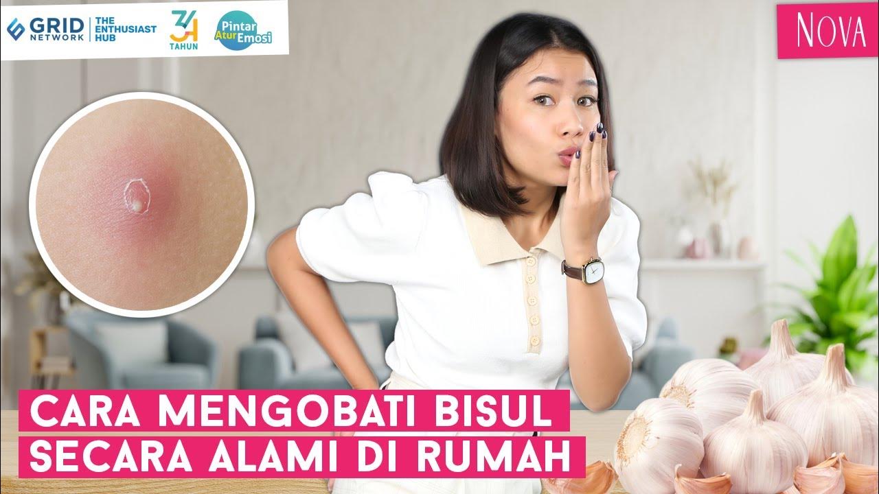 Cara Menghilangkan Bisul Secara Alami di Rumah YouTube