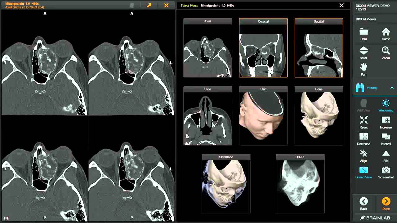 how to open mckesson pacs viewer for patients