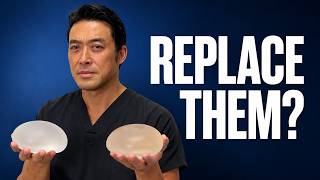 Are Your Breast Implants Too Old What Happens After 10 to 15 Years