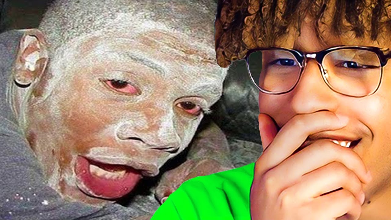 If I Laugh I Lose $100