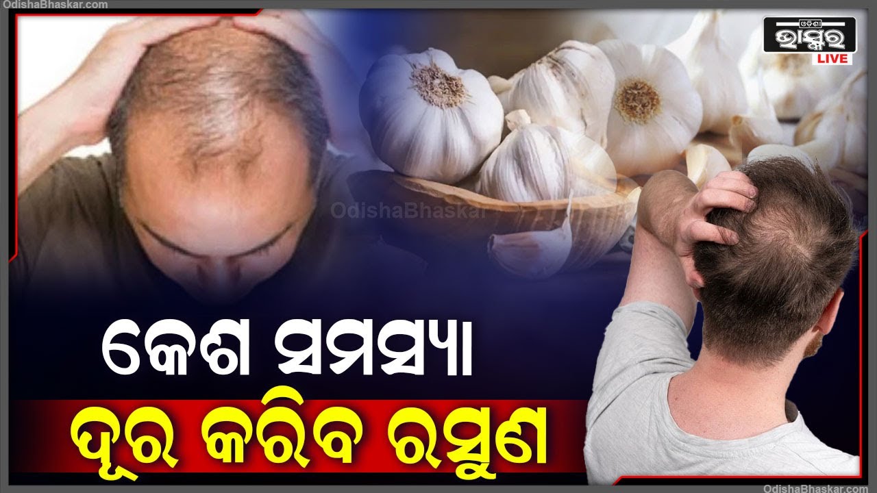 ଆପଣଙ୍କର ଯଦି କେଶ ଝଡୁଛି, ତାହେଲେ ଏହି ଜିନିଷ ବ୍ୟବହାର କରନ୍ତୁ ଯାହା ଆପଣଙ୍କ କେଶ ସମସ୍ୟା ଦୂର କରିଦେବ