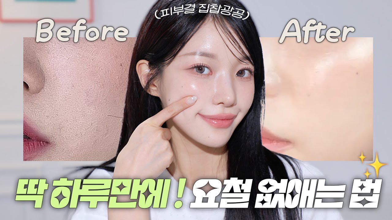 피부과🙅🏻♀️ only홈케어로만! 오돌토돌 요철 없애는 꿀템 다 풉니다..🔥 ft.좁쌀피부, 나비존 요철, 예쁜 애플광 ...