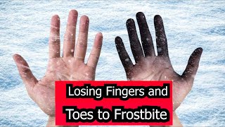 HOW TO SURVIVE FROSTBITE