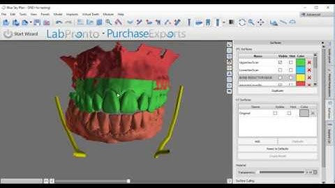 Making a Hybrid From Patient