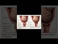 The Cervix Internal os: The opening that holds pregnancy