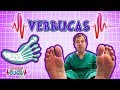 Operation Ouch - Frightful Verrucas! | Immune System