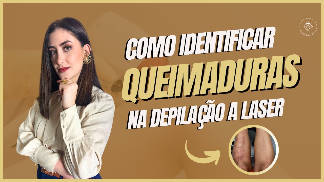 Como identificar queimaduras na depilação a laser - YouTube