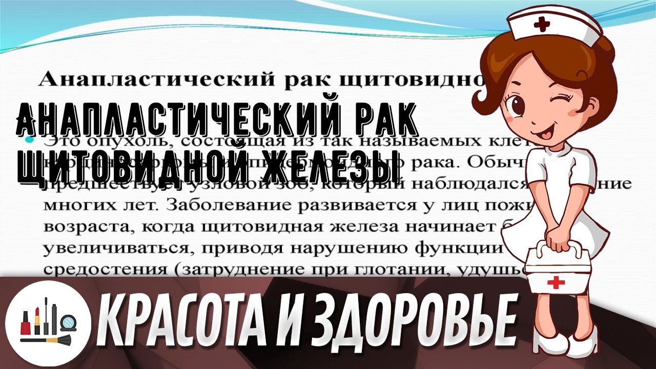Анапластический рак щитовидной железы - YouTube