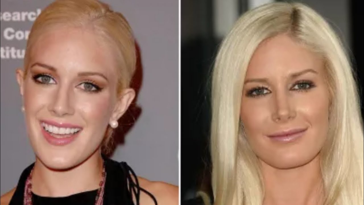 Heidi Montag 'Plastic' Surgery Before and After Photos Why She Almost