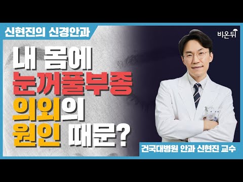 눈꺼풀 부종 (지속되는 눈꺼풀 부종이 있을 때) [신현진의 신경안과#26] / <strong>건국대병원</strong> 신경안과 신현진