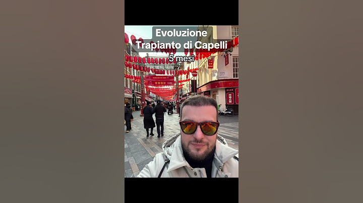 Trapianto di Capelli 🇹🇷 Evoluzione in 10 Mesi #trapianto #capelli #turchia #perte #fyp