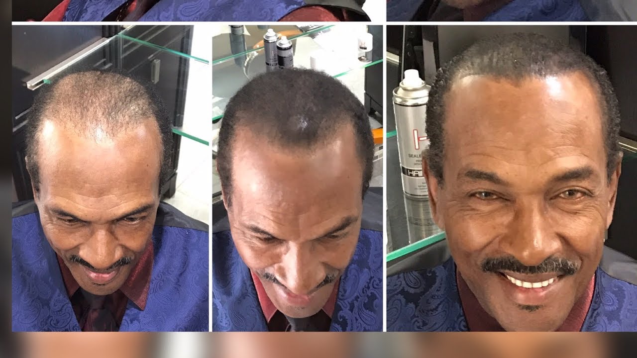 Solutions Hair Barber Thinning Hair Hair Loss Style Youtube