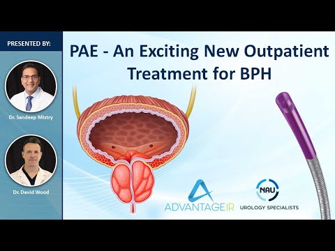 Download PAE   A New Treatment For BPH-Webinar