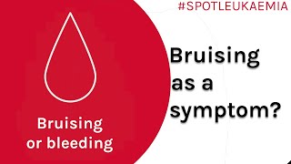 Bruising Symptom Spotlight | Spot Leukaemia