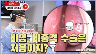 비염수술과 비중격 만곡증 교정 수술, Septoplasty and rhinitis surgery