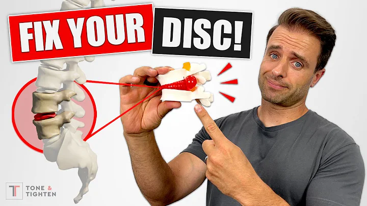 FIX YOUR DISC! Bulging Disc Lower Back Exercises For Pain Relief - DayDayNews