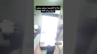 علاج الاكزيما مرهم باربع ريال فقط