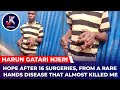 HARUN GATARI NJERi - HOPE AFTER 16 SURGERIES, FROM A RARE HANDS DISEASE THAT ALMOST KILLED ME