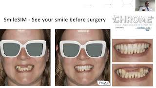 Quoris3D CHROME GuidedSMILE Webinar 1 - The CHROME Records