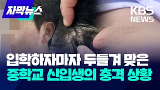 [자막뉴스] 입학하자마자 두들겨 맞은 중학교 신입생의 충격 상황 / KBS 2024.03.12.