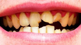 Fixing BROKEN and YELLOW TEETH! screenshot 4