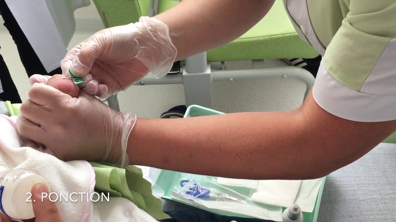 CHRU de Tours - Dépistage néonatal, le prélèvement à la main