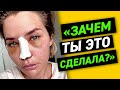 ЗАЧЕМ ТЫ ЭТО СДЕЛАЛА? | Моя ринопластика