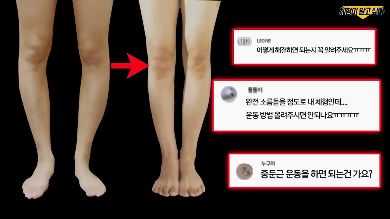 채널A ’나는 몸신이다’🔥 다리교정 전문가로 인정받은 이유 feat. 루틴 공개