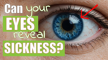 Can IRIDOLOGY Really Predict Your HEALTH? Naturopath Reveals Secrets!